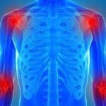 inflammation