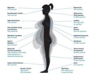 benefits of weight loss surgery