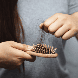 Hair Loss has many causes