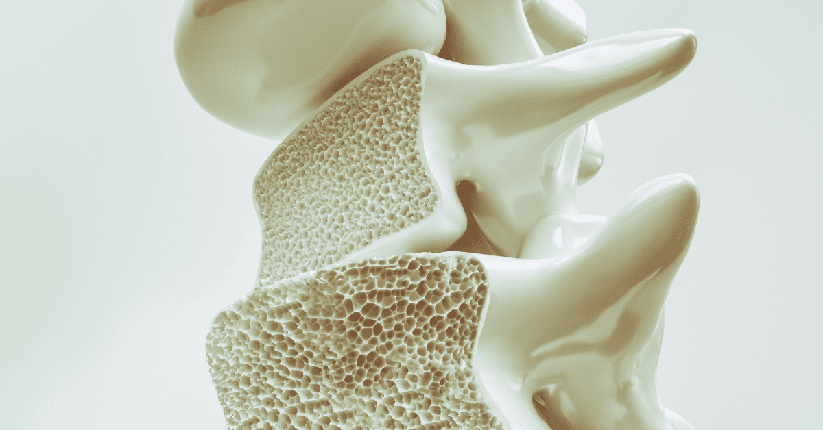 Let's Talk Bone Health!