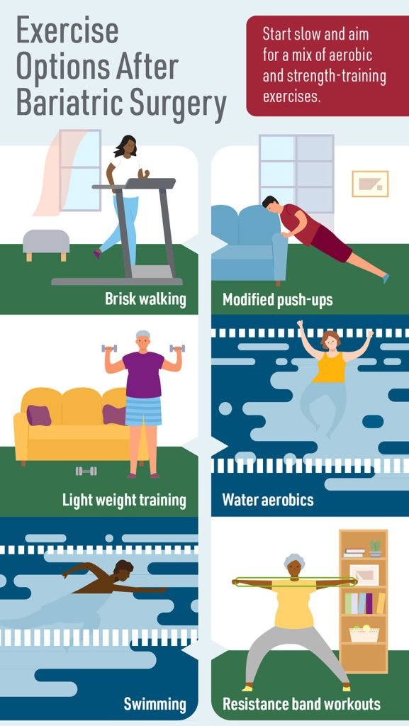 Exercise options after bariatric surgery.